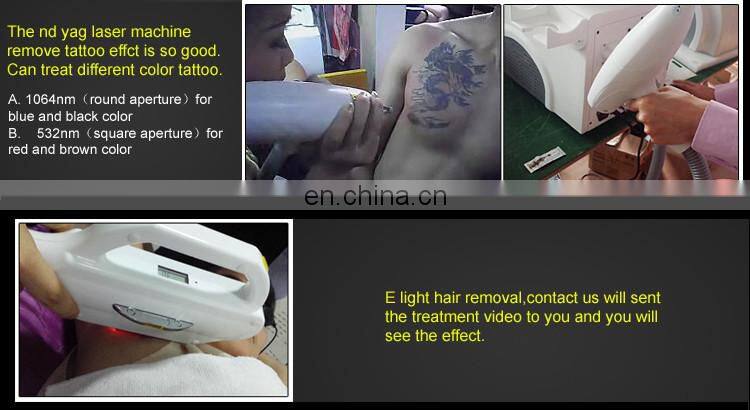 3 in 1 Multifunction beauty machine china ipl hair removal shr opt elight laser machine