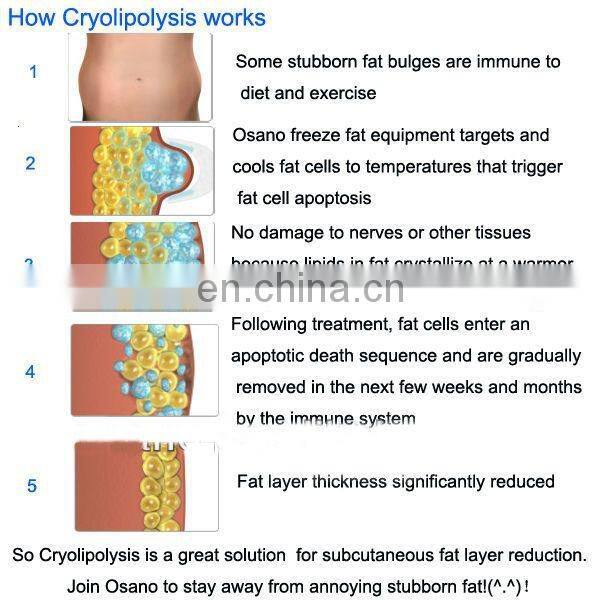 3 Cryo Handle Fat Freezing Cold Lipo For Beauty Salon