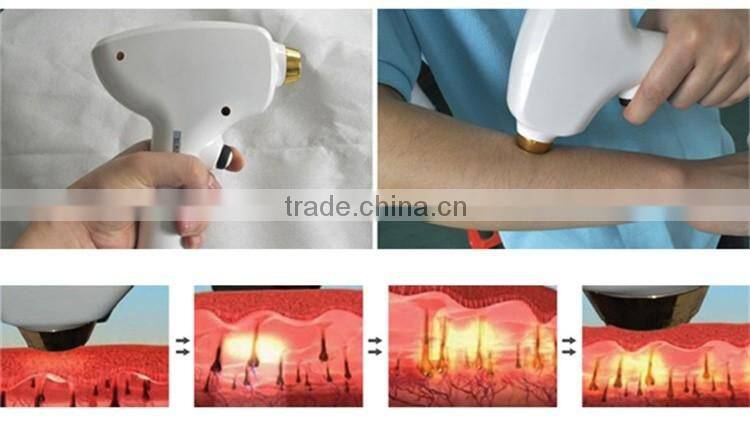 Professional laser hair removal machine/808nm diode laser hair removal