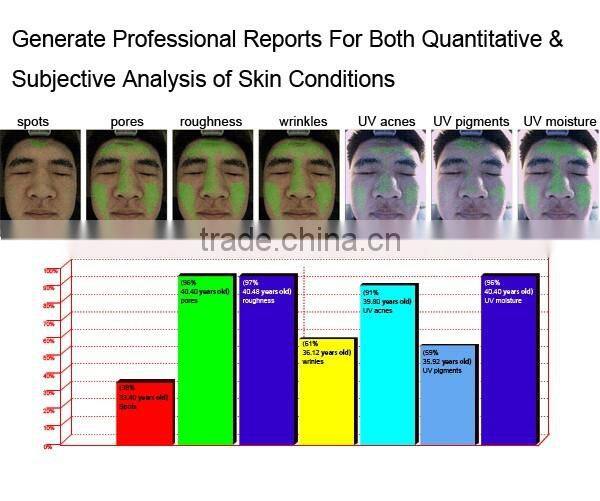 Hot sale portable skin analyzer machine 3D magic mirror skin test machine