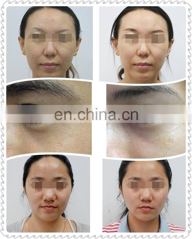 DEESS oem household mini skin rejuvenation anti aging machine eye care microcurrent 5 in 1 face lift machine