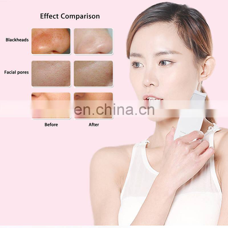 Ultrasonic Ion Skin Scrubber Facial Care Ultrasonic Scrubber Cleaner Blackhead Removal Face Peeling Extractor Skin Beauty Device