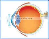 Digital Rigid contact lens for corneal reshape / MCT/ Luxuriant metamorphosis of RGP Lenses