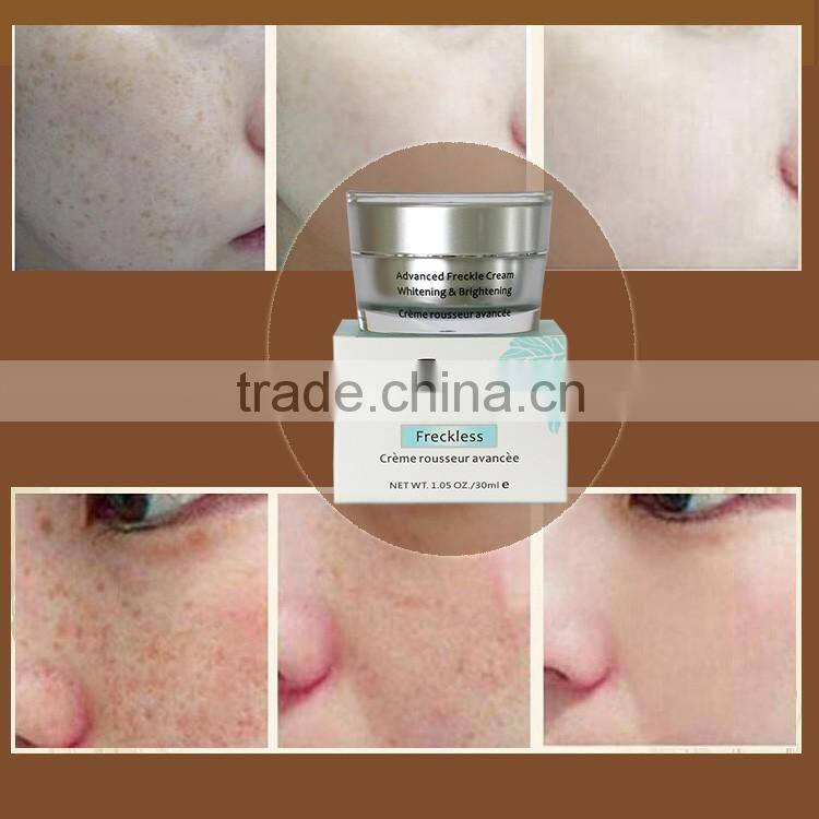 Facial Skin beauty products best modern design face whitening anti freckle cream