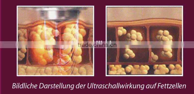 Factory sale cavitation ultrasonic weight loss vacuum slimming machine