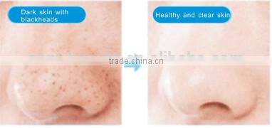 360 rotation Waterproof ultraSonic facial cleansing brush