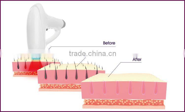 Salon used safety all colors hair portable 808nm diode laser permanent hair removal beauty machine