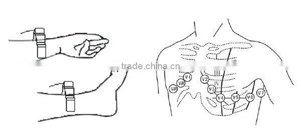 High-Quality Disposable Automatic Measurement Auto Handheld Cheap 3 Channels ECG Machine