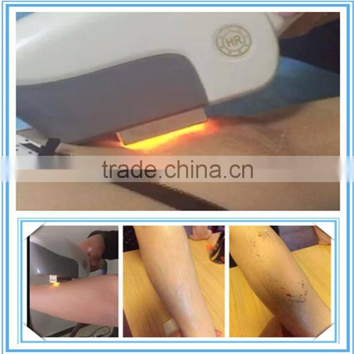 elite ipl shr laser hair removal machine for sale