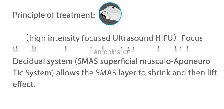 2019 New Arrivals Ultrasound Women's Private Vaginal Rejuvenation Beauty&Personal Care