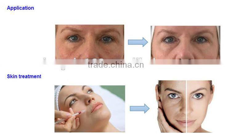 20ml PRP kit Centrifuge for Yes or BS or Dr. PRP kit or Regenlab or Mycell PRP kit