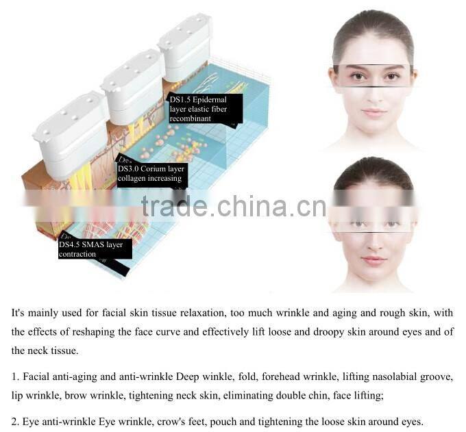 Hot new product portable ultrasound hifu wrinkle removal system / machine hifu