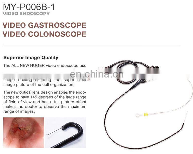 MY-P006B Medical HD Endoscope System with Video Gastroscope and Video Colonoscope
