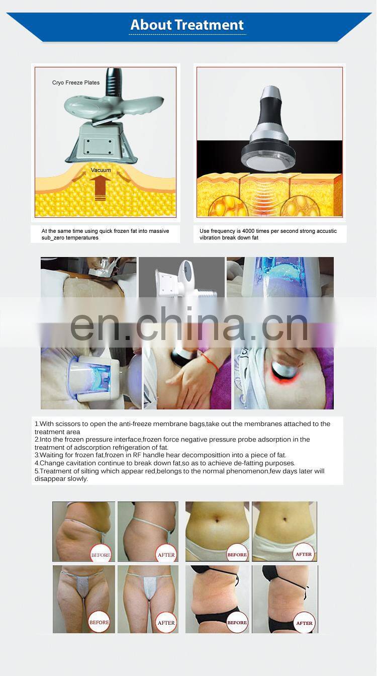 2019 Portable celulite remover and vacuum machine body slimming and double chin removal