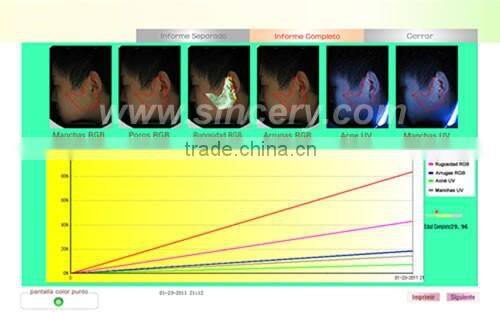 Facial Reveal Skin And Hair Analysis Machine for Skin Testing