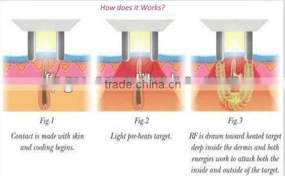 Professional E-light Beauty Machine For Skin Care Hair Removal