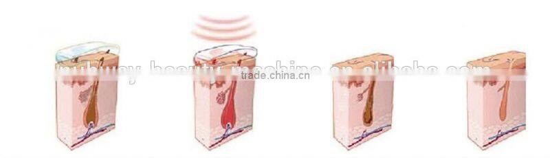 808nm high power semiconductor laser diodes