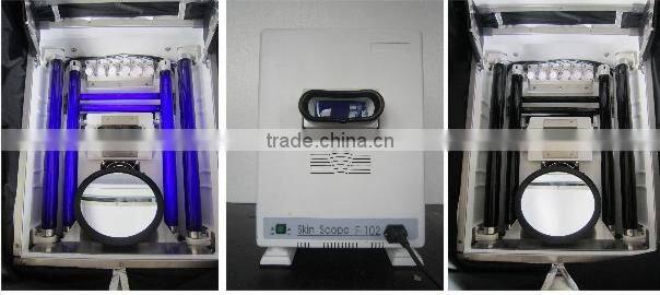 Professional Diagnosis Skin analyzer scanner machine with high quality