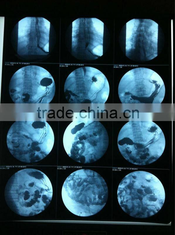 dry thermal film,dry x-ray film, dry imaging film
