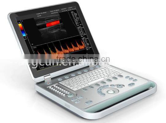 AG-BU005 medical color doppler ultrasound