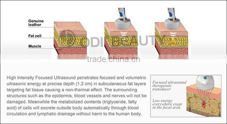 Alibaba express ultrasound hifu body slimming shaping equipment