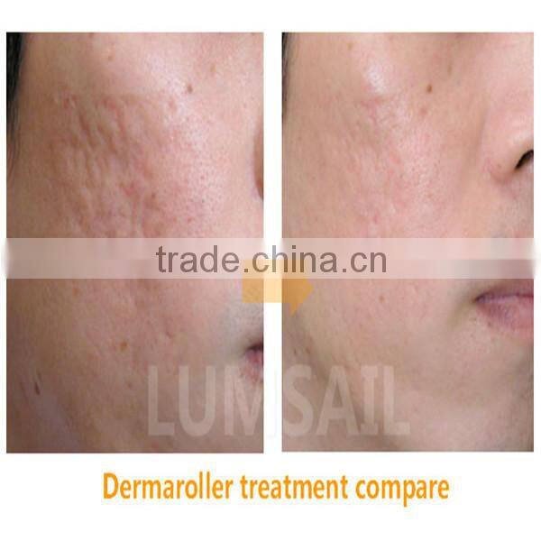 2015 factory direct sale skin care roller micro needle derma roller/derma cosmetic