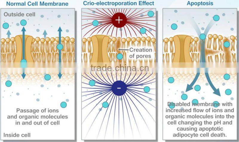 Perfect electroporation skin tightening rf mesoterapia beauty device - New Cellactor