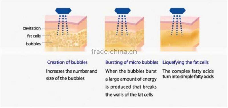 Manufacturer supply 4 handles quick slimming fda approved ultrasonic cavitation liposuction beauty equipment