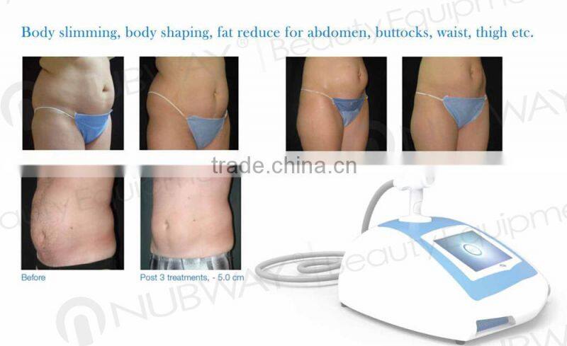 Nubway technology!!! korean hifu 2015 for body shape machine