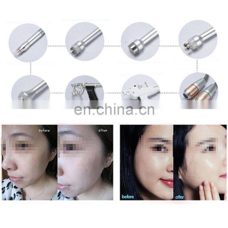 Multi-functional 11 In 1 Oxygen Injection Water Spray Small Bubble Skin Care Aqua Facial Beauty Machine