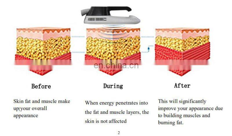 New technology 360 cryo fat freezing electromagnetic abdominal muscle stimulator hip trainer