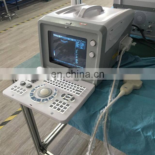 HC-A001 Happycare Full digital Portable 10 inch laptop ultrasound machine scanner Cheapest cheap ultrasound machine device