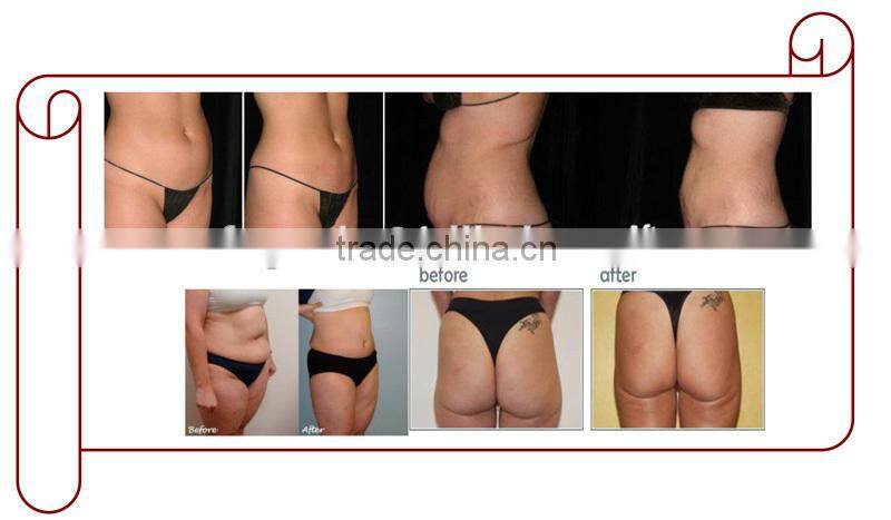 Beijing Fogool Portable 40K Cavitation & Multipolar RF Slimming Machine