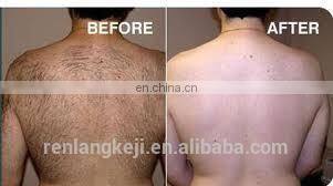 Effective Portable IPL E-light OPT Skin Rejuvenation Hair Removal Laser RF Wrinkle Removal Skin Tightening Machine