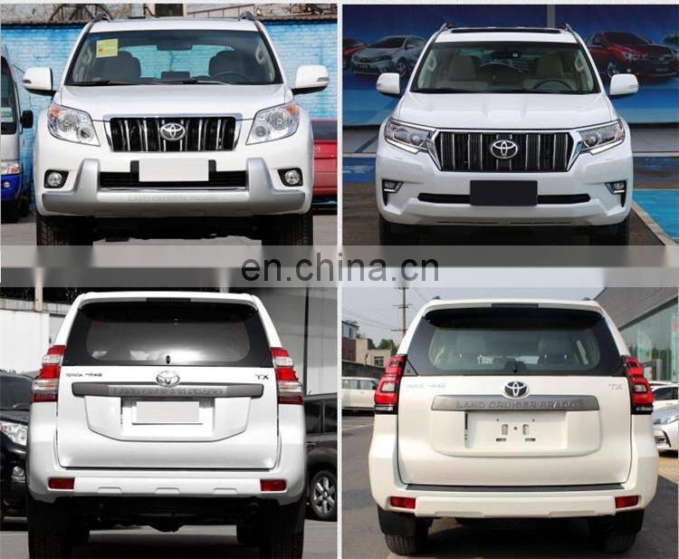 Body kit for FJ150 2010 to 2018 new style full set