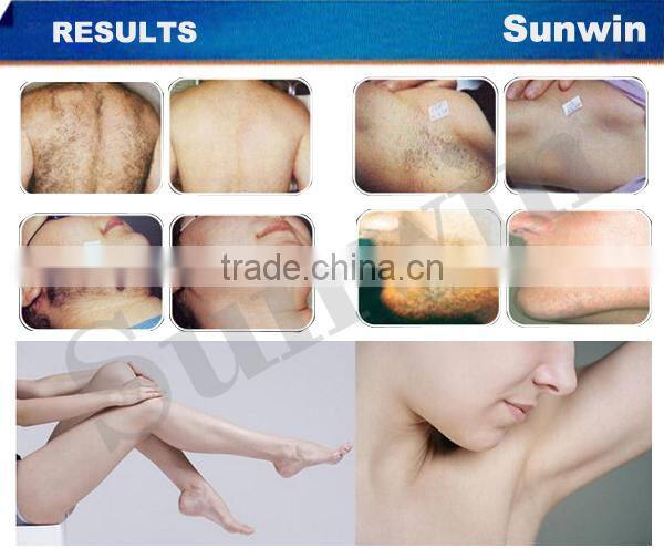 Color Touch Screen RF SHR IPL Hair Removal Machine SW-1605E