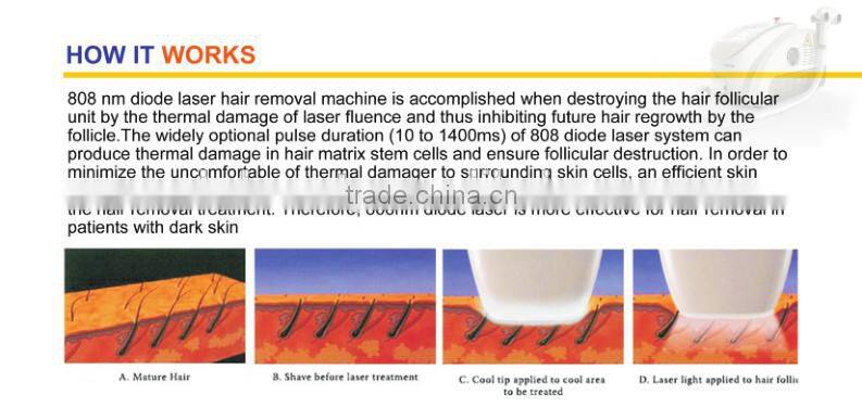 Diode Laser Hair Removal 808nm Diode Laser Machine
