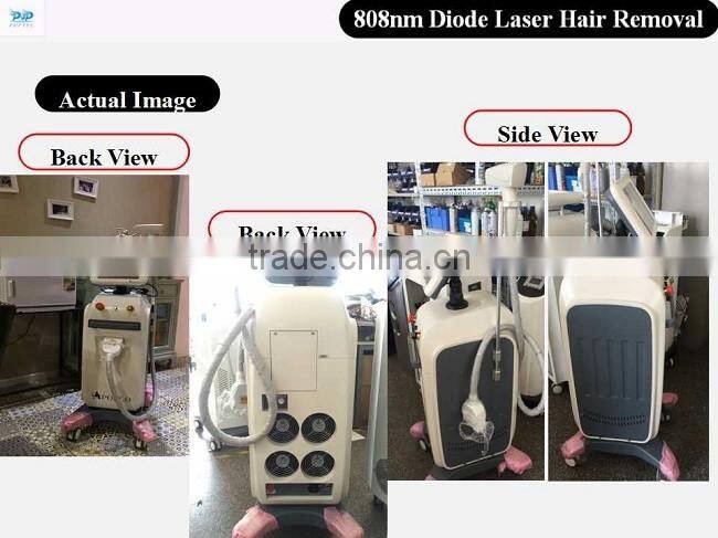 808nm Diode Laser machine for hair removal laser hair removal machine