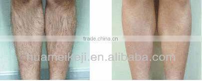 mini ipl laser hair removal machine