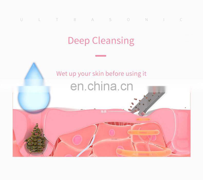 portable ultrasonic scaler sonic peeler skin scrubber machine for lady