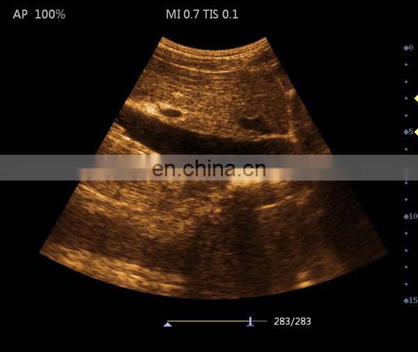 HC-A006B Full digital 15 inch Laptop Ultrasound machine with competitive price(ARM based)