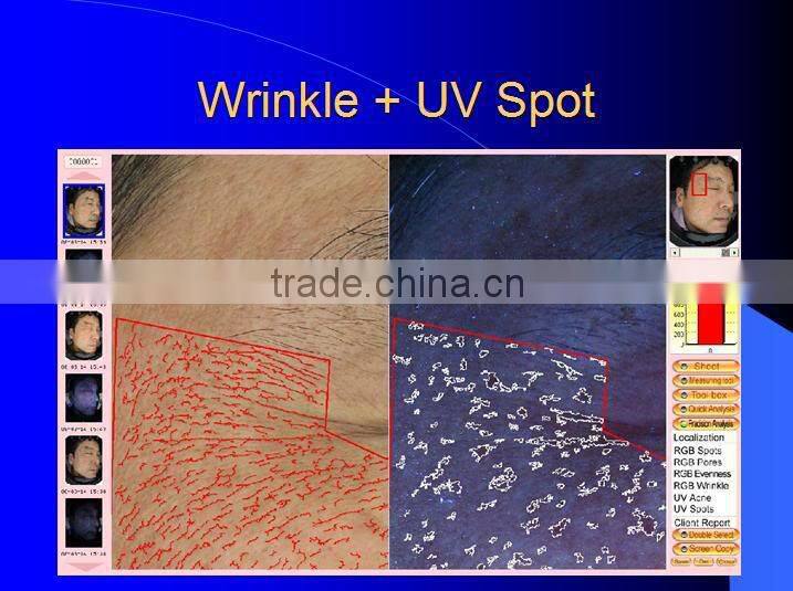 magic mirror skin analyzer