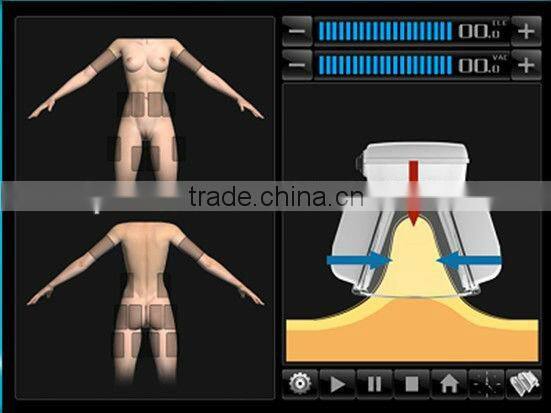 Coolipo V9 Cavitation Machine