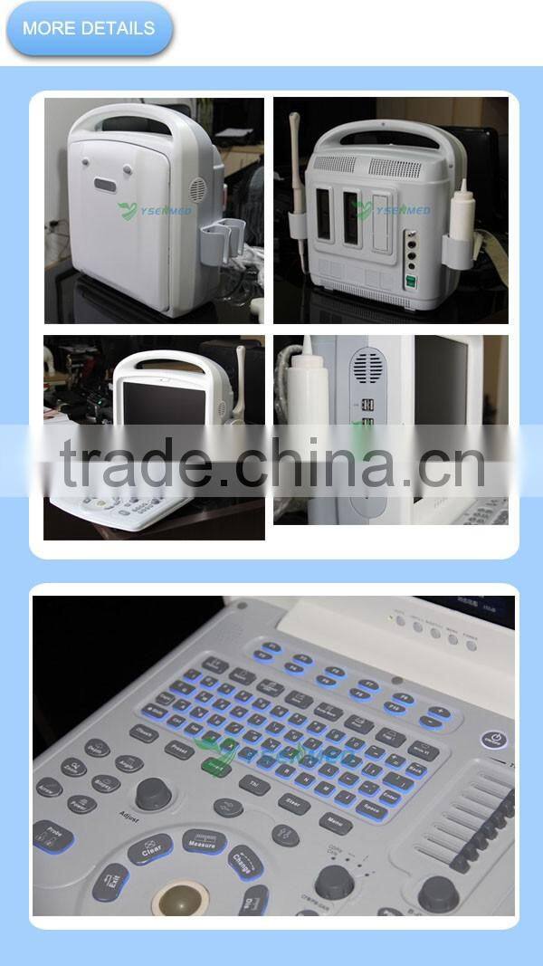 Portable Pregnancy Test veterinary ultrasound scanner