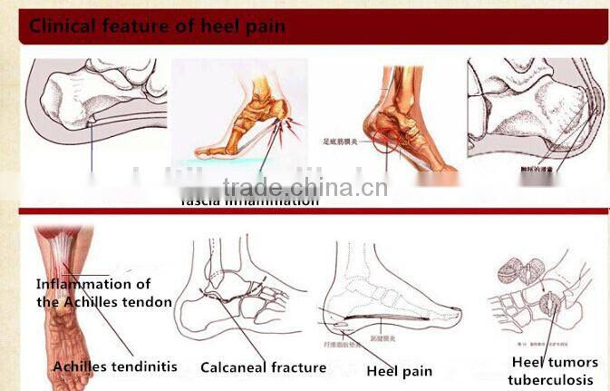2015 hot selling foot patches,Healthcare foot patch for foot sickness