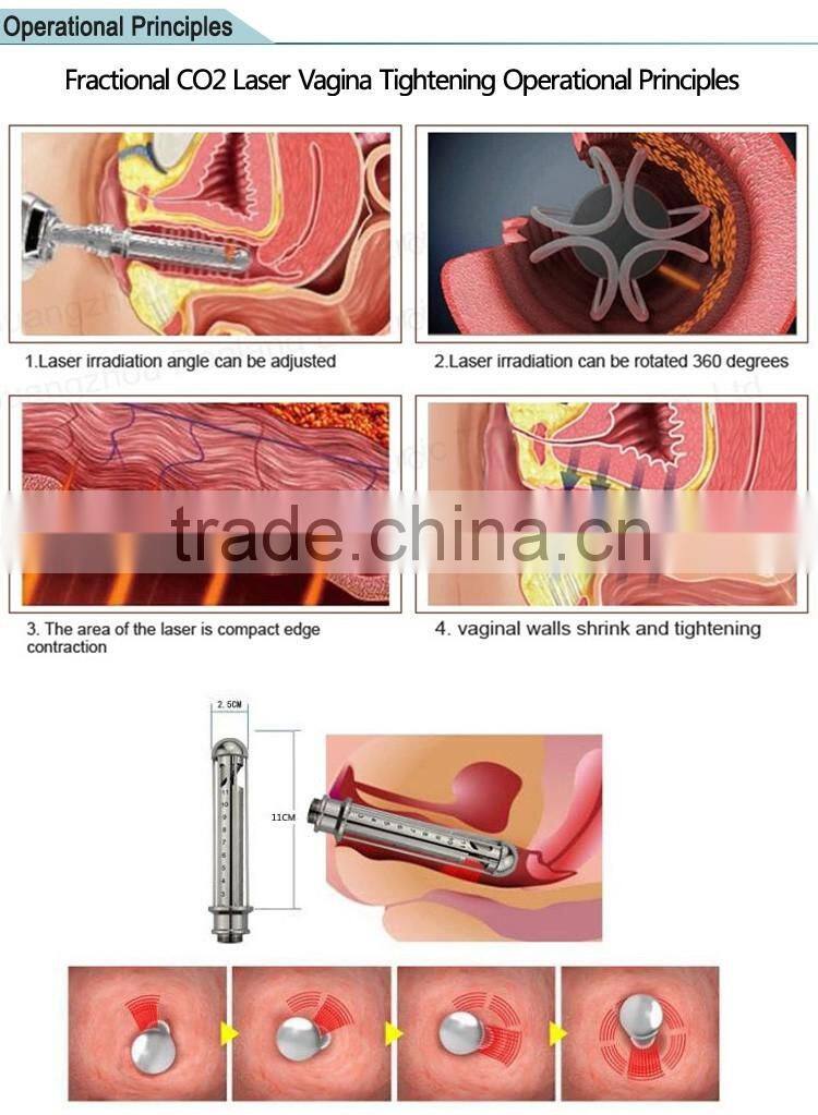Beauty Device Fractional CO2 Laser for Equipment Vaginal Tightening Machine