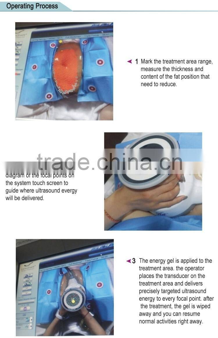 2016 Best selling focused ultrasound salon use machine for women body shape