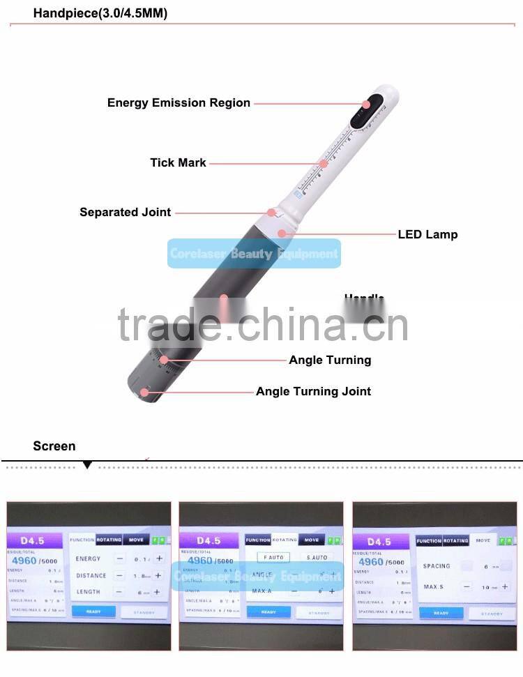 New technology Vaginal Hifu system Your privacy protection vagina tightening ultrasound hifu