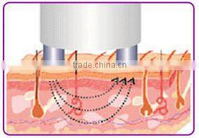 Home rf skin tightening machine facial skin rejuvenation device for anti aging with CE PSE ROHS certificates