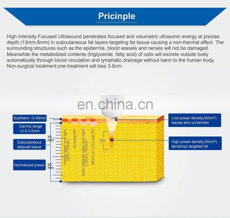 Hifu technology slimming technologoy